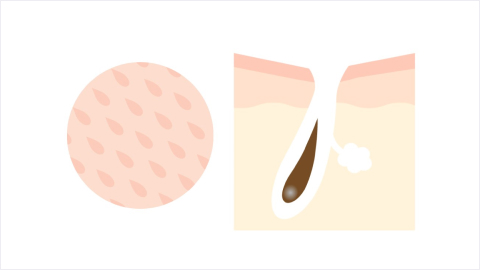 加齢、肌のハリ・弾力の低下