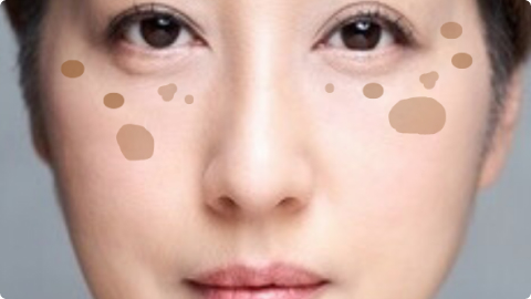 紫外線