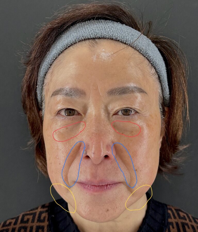 母親の自然な若返りを目指す｜岐阜・大垣市の美容皮膚科・脱毛の大垣美容クリニック
