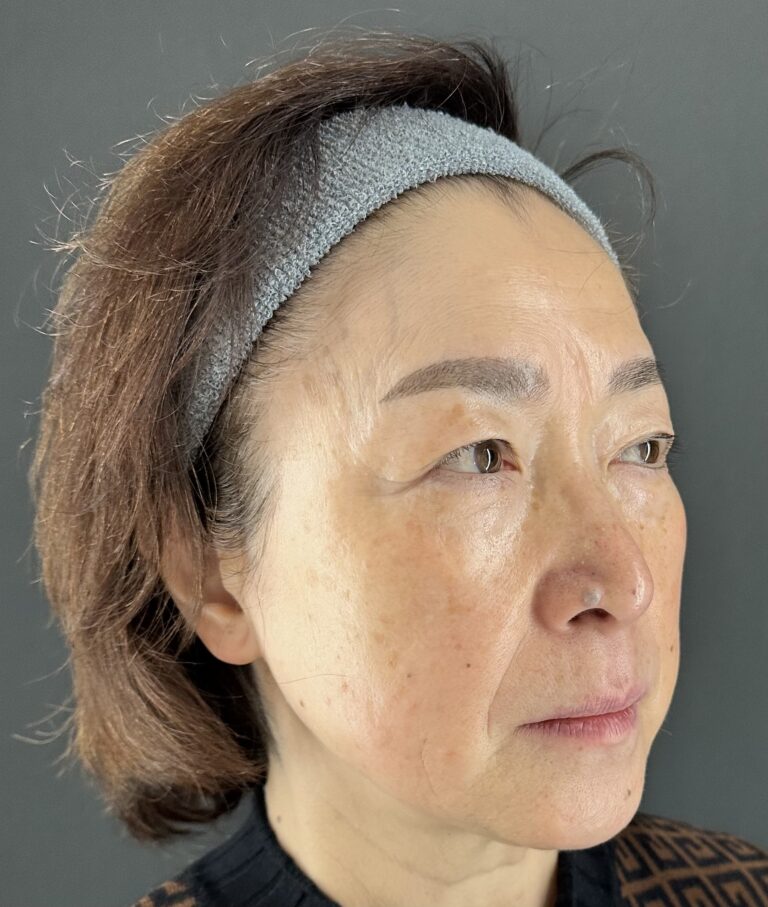 母親の自然な若返りを目指す｜岐阜・大垣市の美容皮膚科・脱毛の大垣美容クリニック