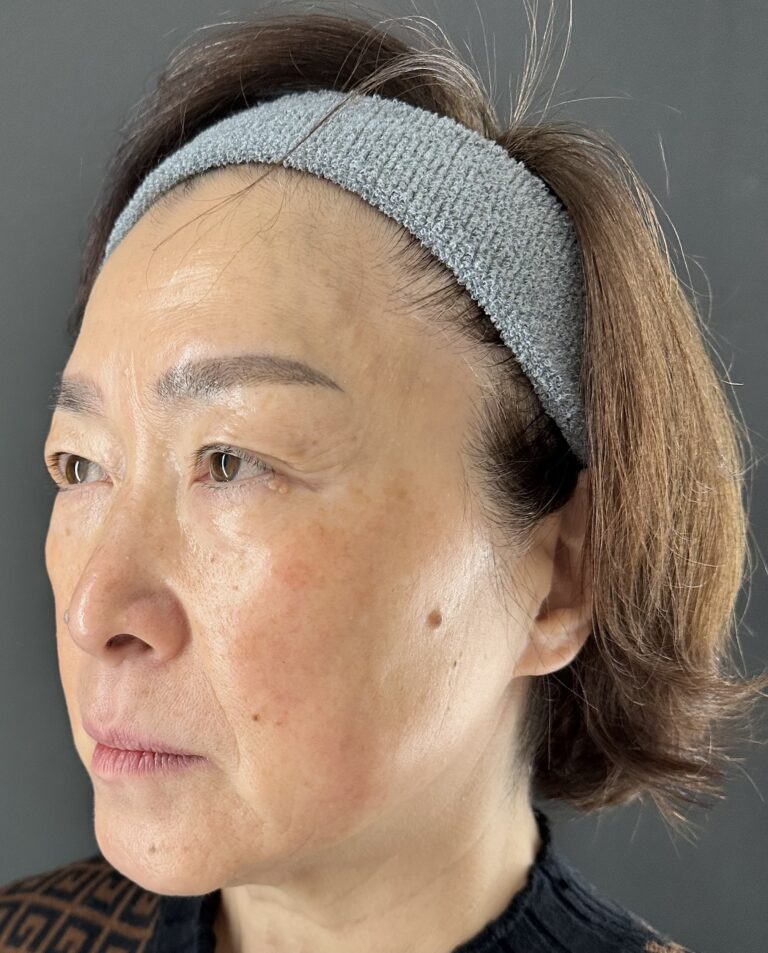 母親の自然な若返りを目指す｜岐阜・大垣市の美容皮膚科・脱毛の大垣美容クリニック