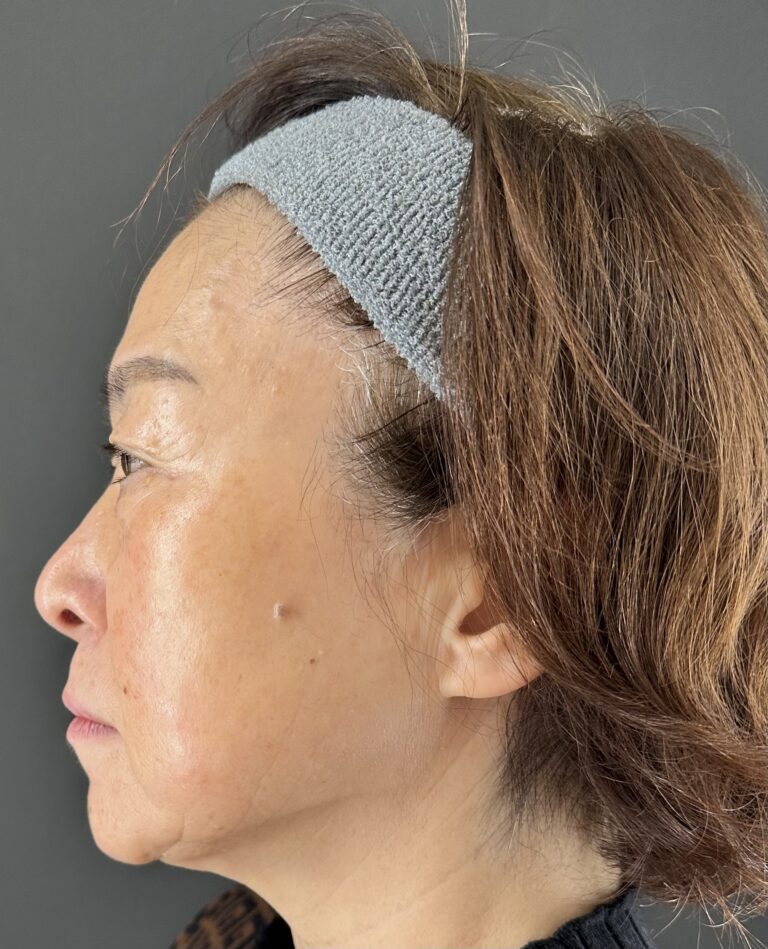 母親の自然な若返りを目指す｜岐阜・大垣市の美容皮膚科・脱毛の大垣美容クリニック