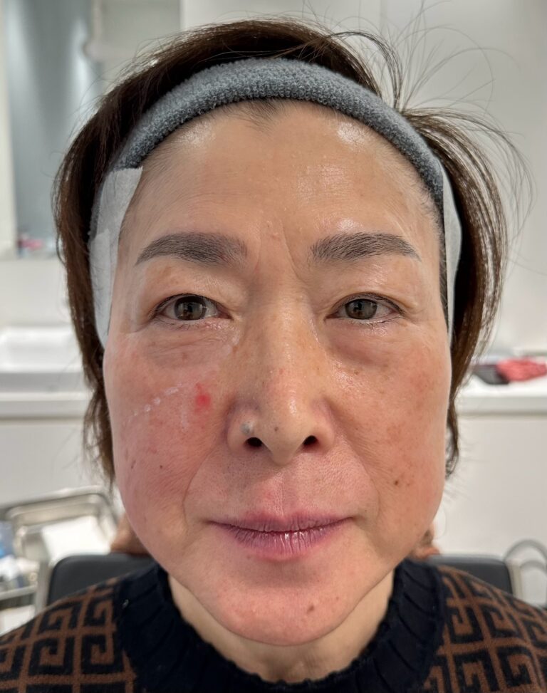 母親の自然な若返りを目指す｜岐阜・大垣市の美容皮膚科・脱毛の大垣美容クリニック