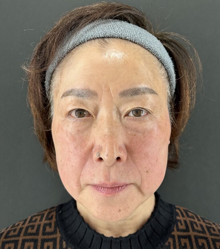 母親の自然な若返りを目指す｜岐阜・大垣市の美容皮膚科・脱毛の大垣美容クリニック