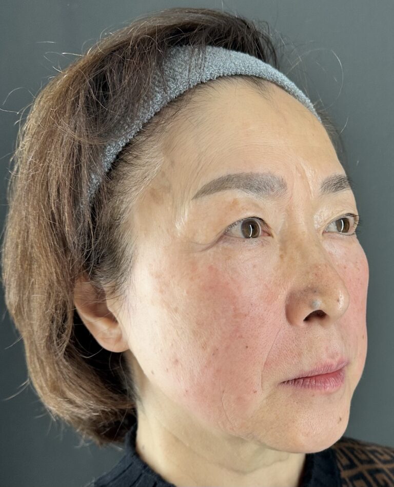 母親の自然な若返りを目指す｜岐阜・大垣市の美容皮膚科・脱毛の大垣美容クリニック