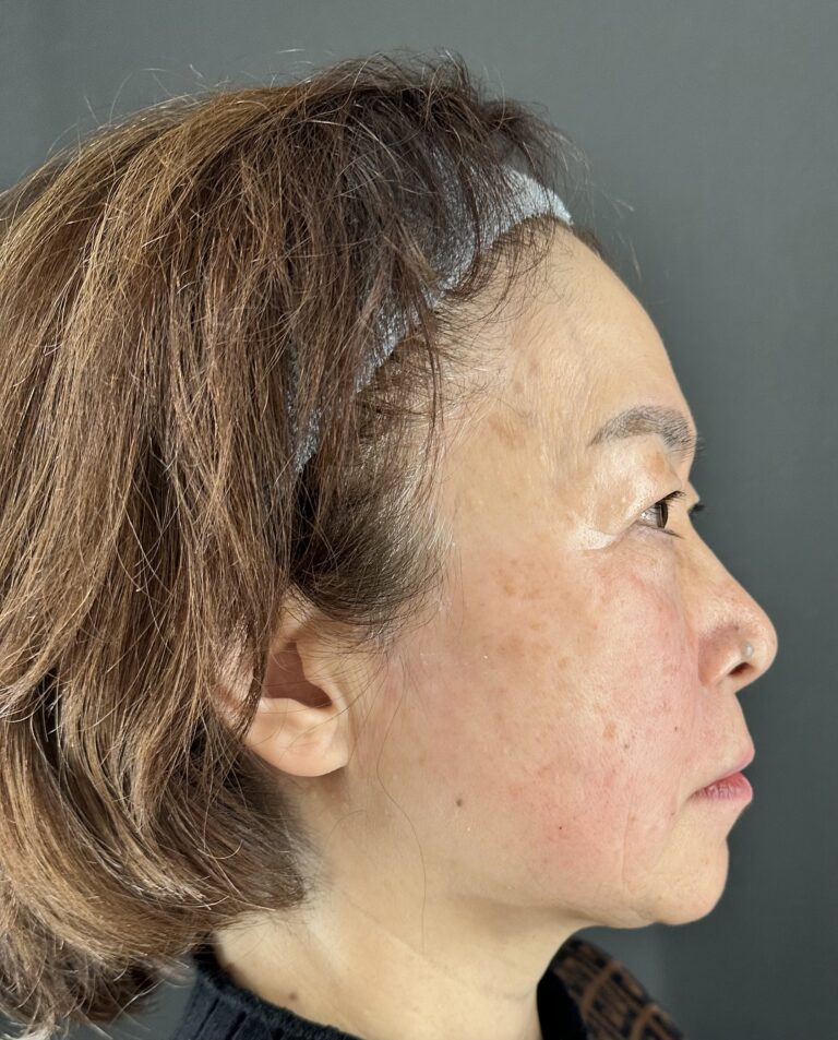 母親の自然な若返りを目指す｜岐阜・大垣市の美容皮膚科・脱毛の大垣美容クリニック