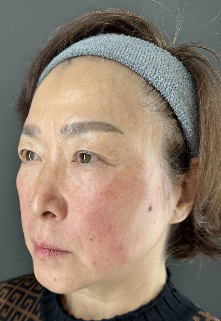 母親の自然な若返りを目指す｜岐阜・大垣市の美容皮膚科・脱毛の大垣美容クリニック