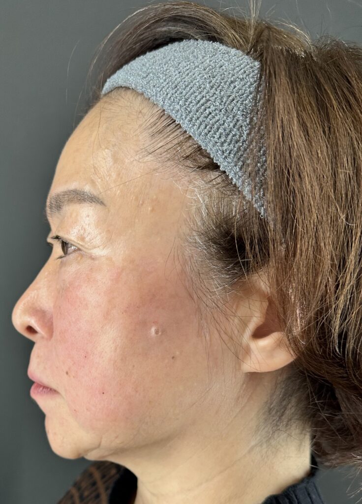 母親の自然な若返りを目指す｜岐阜・大垣市の美容皮膚科・脱毛の大垣美容クリニック