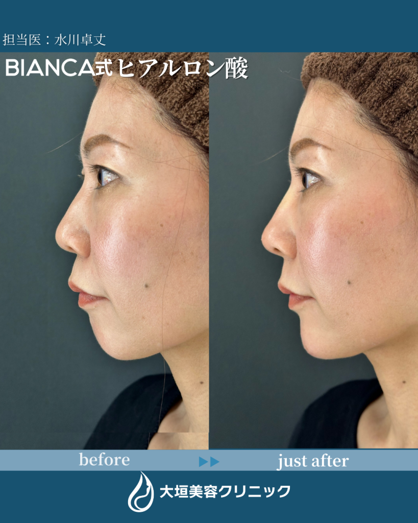 Eラインを整える　Dr.水川卓丈