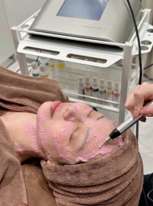 メソナJはダウンタイムなしの美肌治療｜岐阜・大垣市の美容皮膚科・脱毛の大垣美容クリニック