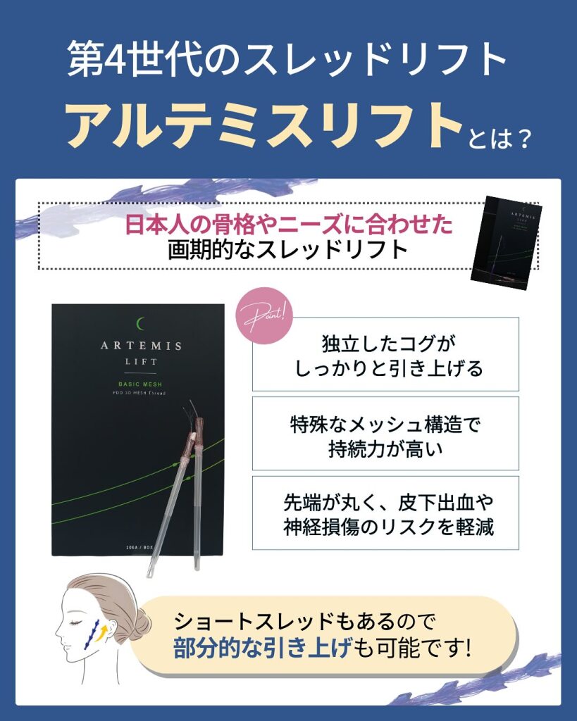 糸リフト（スレッドリフト）