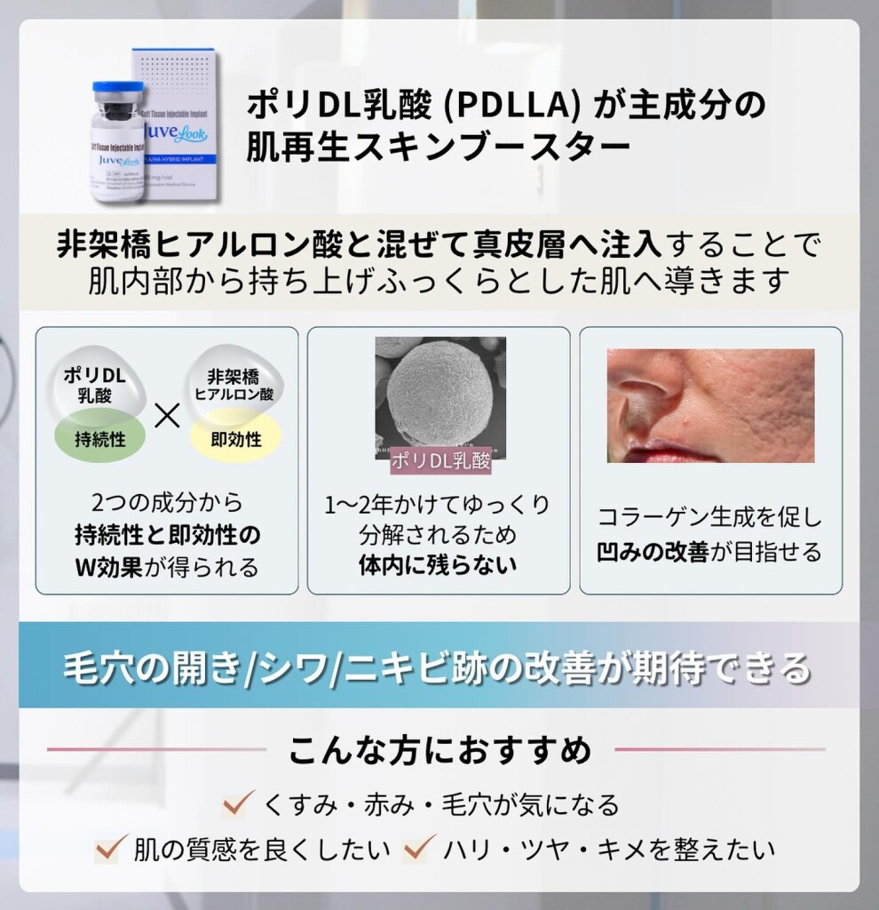 ジュべルック