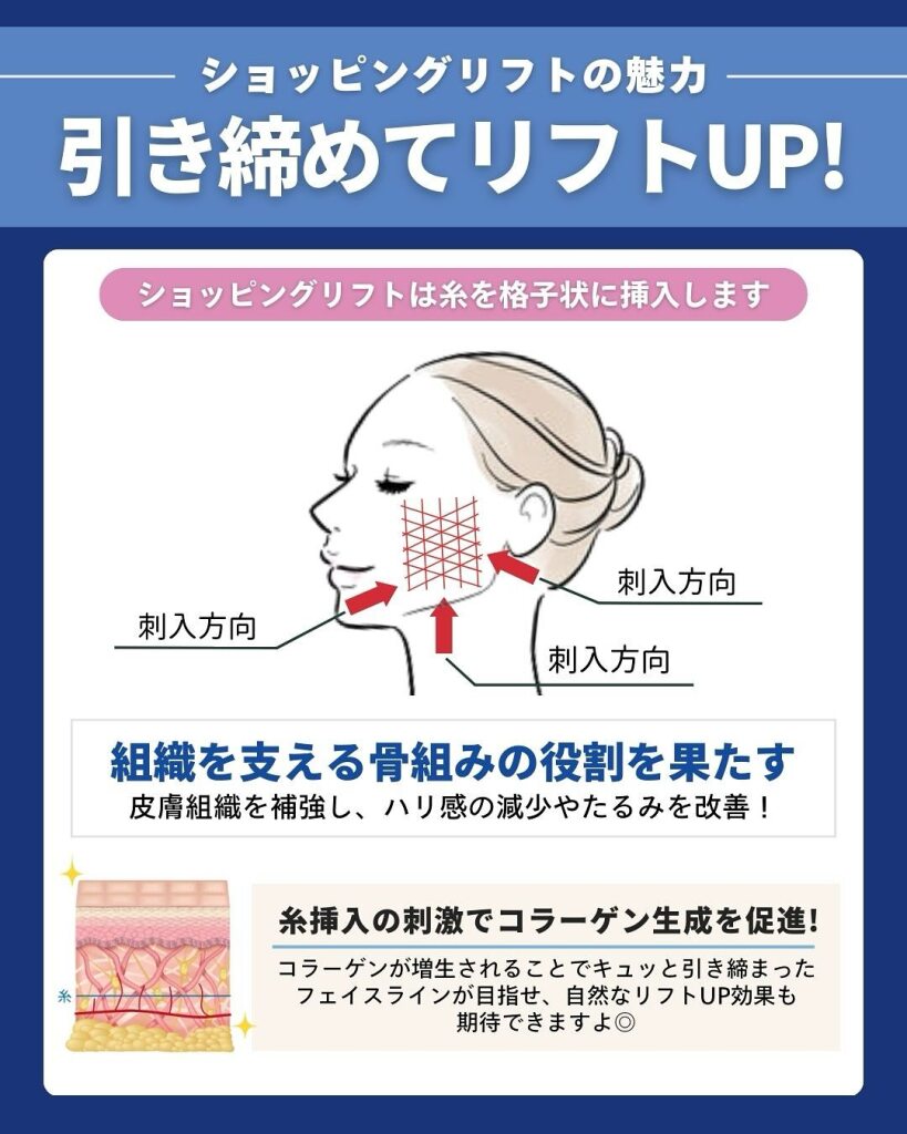 ショッピングリフト