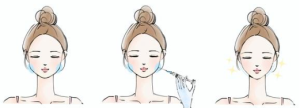 エラボトックスで小顔効果とエラ張り解消｜岐阜・大垣市の美容皮膚科・脱毛の大垣美容クリニック