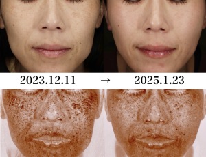 岐阜で美肌を目指すなら「大垣美容クリニック」｜岐阜・大垣市の美容皮膚科・脱毛の大垣美容クリニック