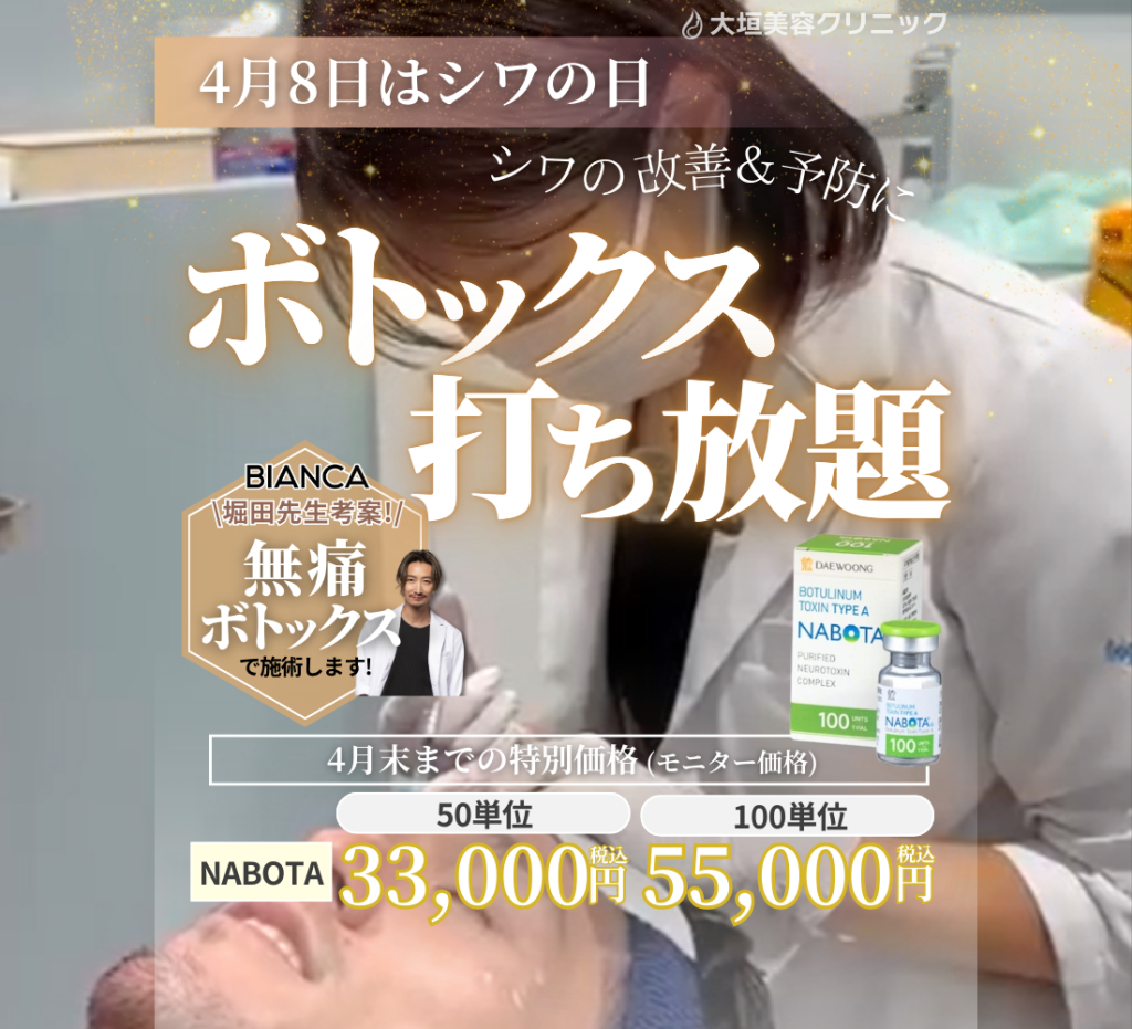 4月CPのボトックス打ち放題で目指せスッキリフェイス