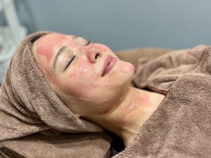 「メソナSA」肌の透明感とハリを叶えるスペシャルケア｜岐阜・大垣市の美容皮膚科・脱毛の大垣美容クリニック