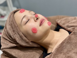 「メソナSA」肌の透明感とハリを叶えるスペシャルケア｜岐阜・大垣市の美容皮膚科・脱毛の大垣美容クリニック