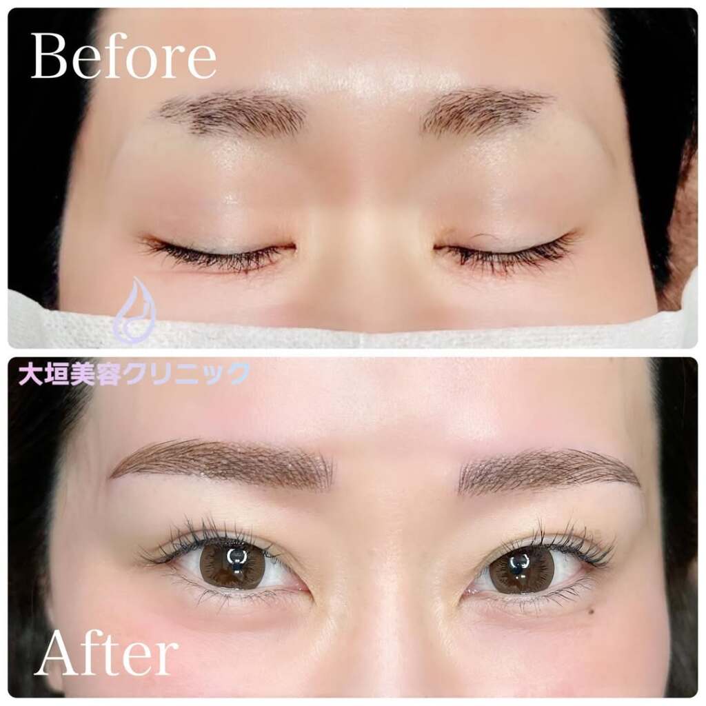 アートメイク