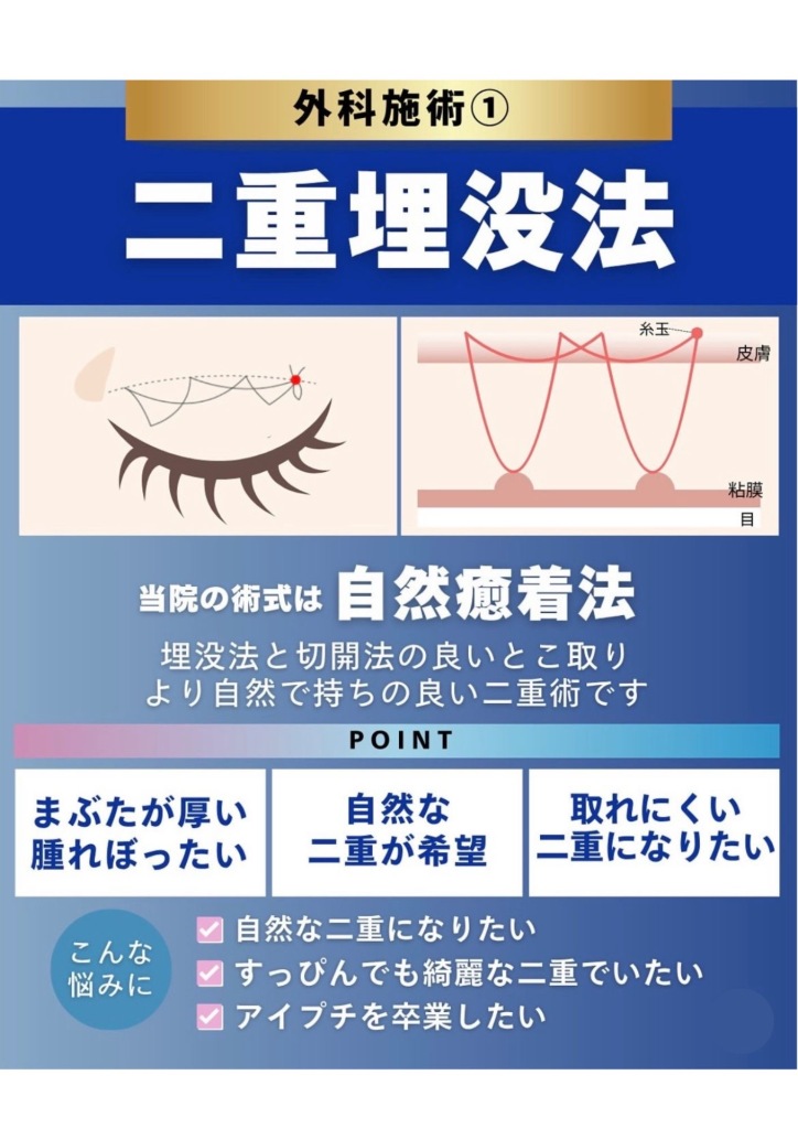 二重埋没するなら、大垣美容クリニックがおすすめ✨