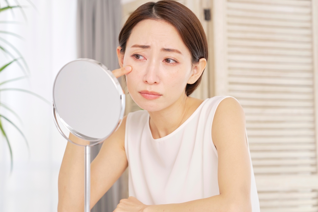 目の下のたるみが気になる方へ｜岐阜の大垣美容クリニックが原因や対処方法、たるみに効く施術の種類を解説