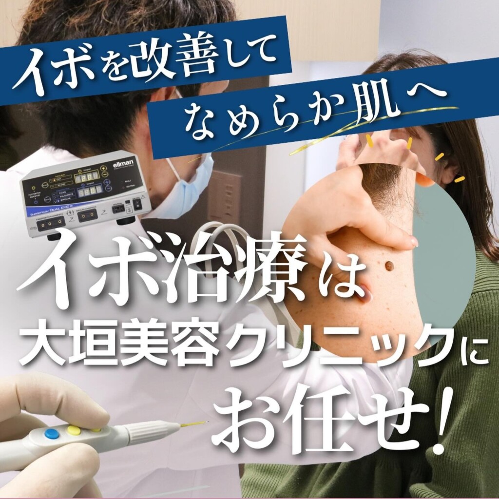 いぼ取り