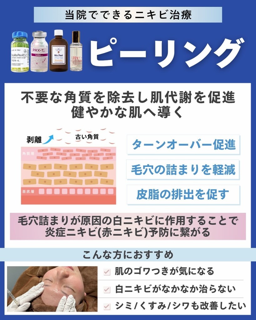 岐阜・大垣美容クリニックの美容皮膚科スタッフが教えるニキビ治療の選び方と治療別メリット｜岐阜・大垣市の美容皮膚科・脱毛の大垣美容クリニック