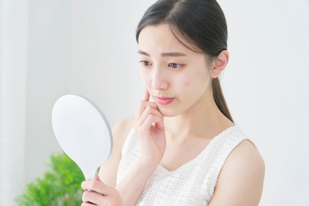 岐阜・大垣美容クリニックの美容皮膚科スタッフが教えるニキビ治療の選び方と治療別メリット