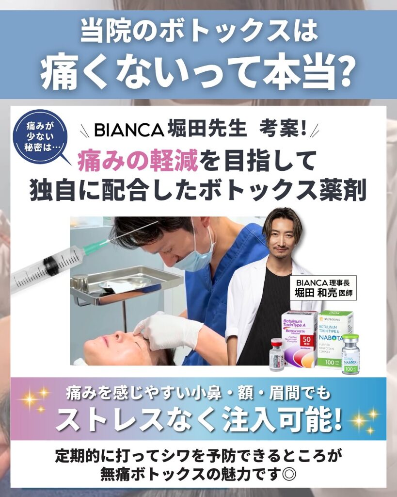 ボトックス