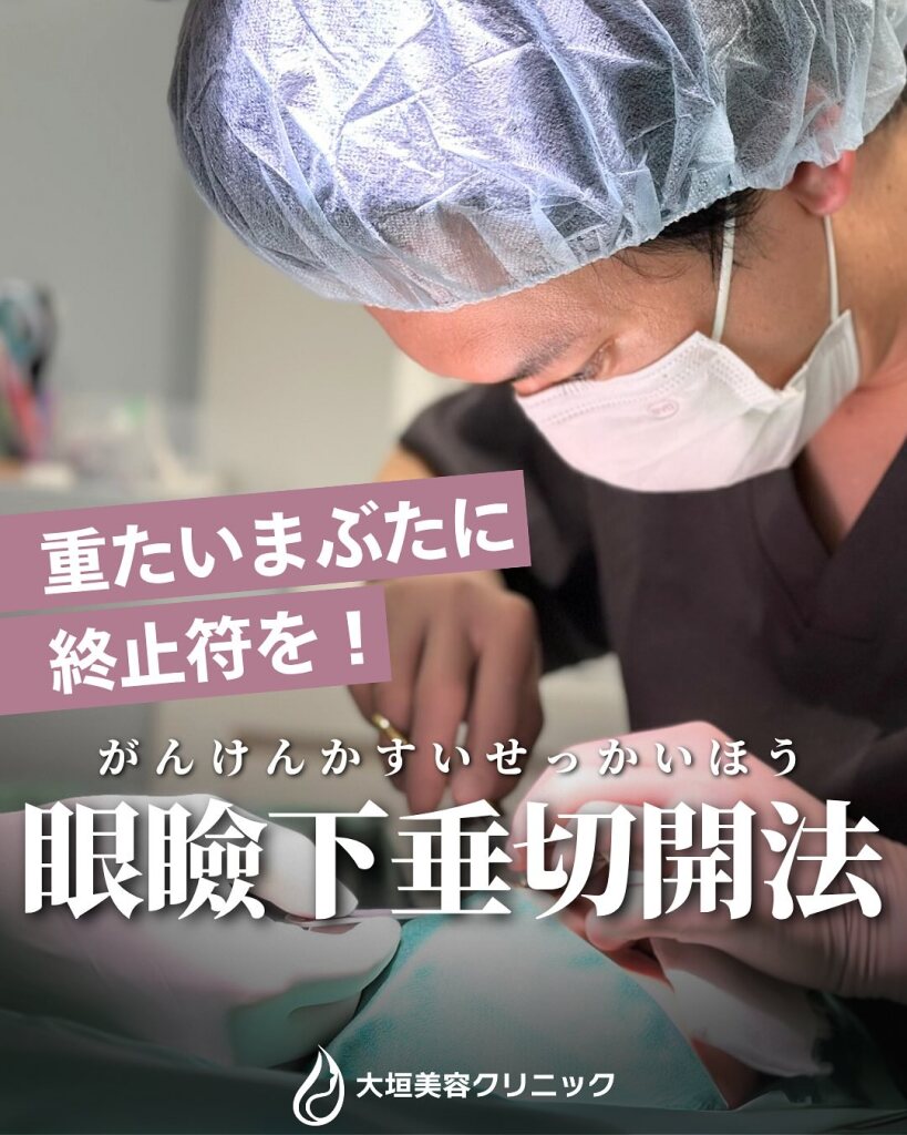 【岐阜で眼瞼下垂の名医を探している方へ】まぶたの悩みに寄り添う“丁寧な眼瞼下垂切開法”とは｜大垣美容クリニック