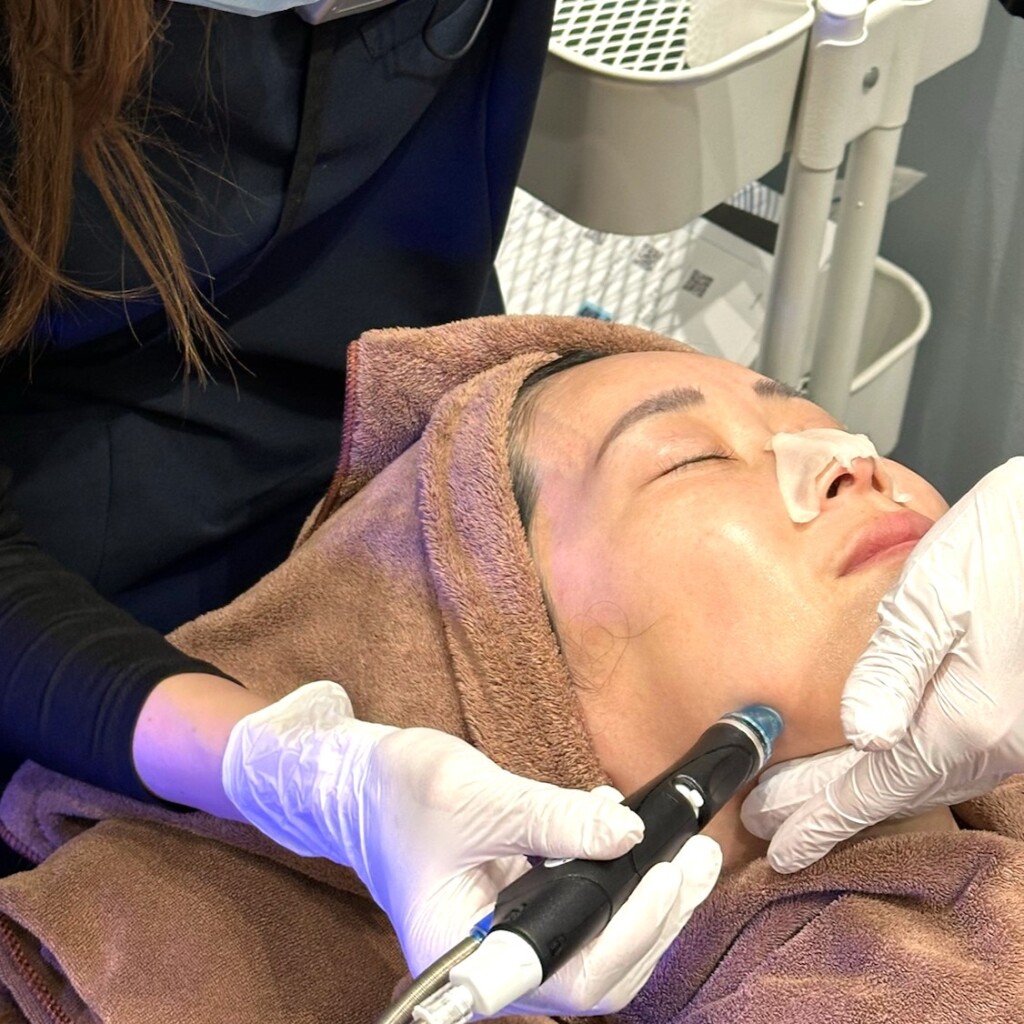 ハイドラフェイシャル｜岐阜・大垣市の美容皮膚科｜大垣美容クリニック（アクアウォーク大垣内）