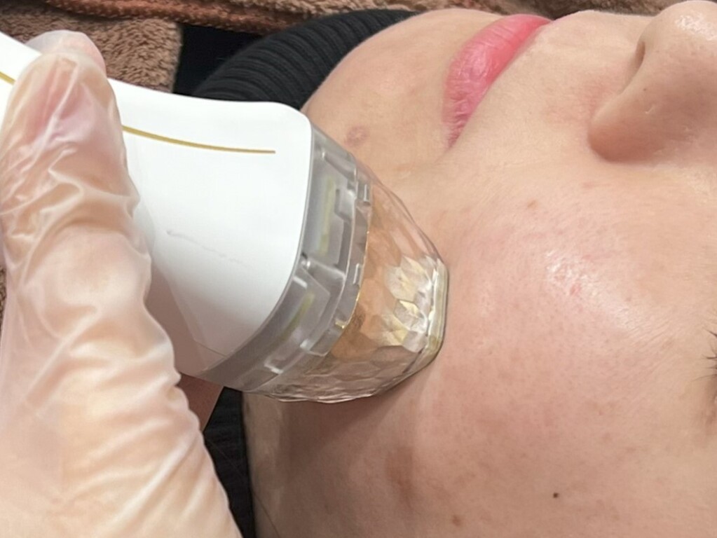 毛穴治療は岐阜で！あなたの毛穴はどのタイプ？クリニックで叶えるなめらかな肌｜大垣美容クリニック