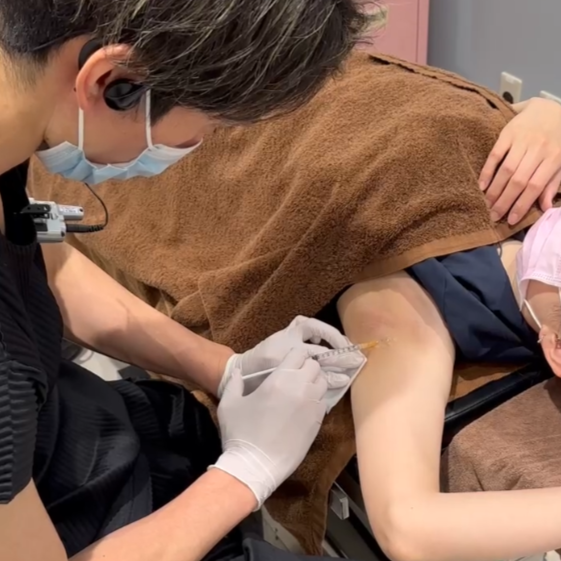 脇ボトックス